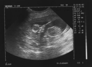 16.01.2003; so sah ich in der 16. SSW aus
