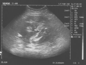 der kleine Unterschied